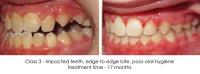 Henn Orthodontics image 3
